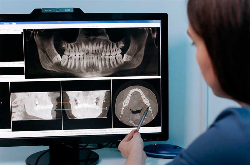 Las emergencias dentales más comunes